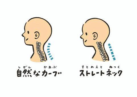 静岡市葵区で疲れ解消！ストレートネックの改善法